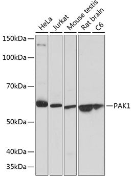 PAK1 Rabbit mAb