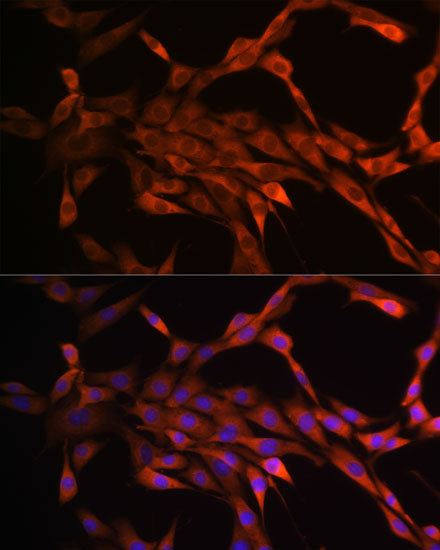 PAK1 Rabbit mAb