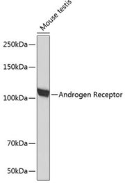 Androgen Receptor Rabbit mAb