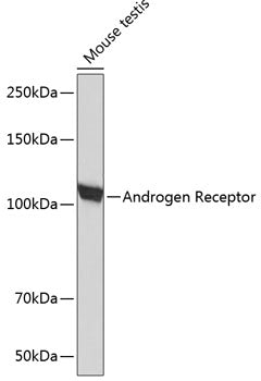 Androgen Receptor Rabbit mAb