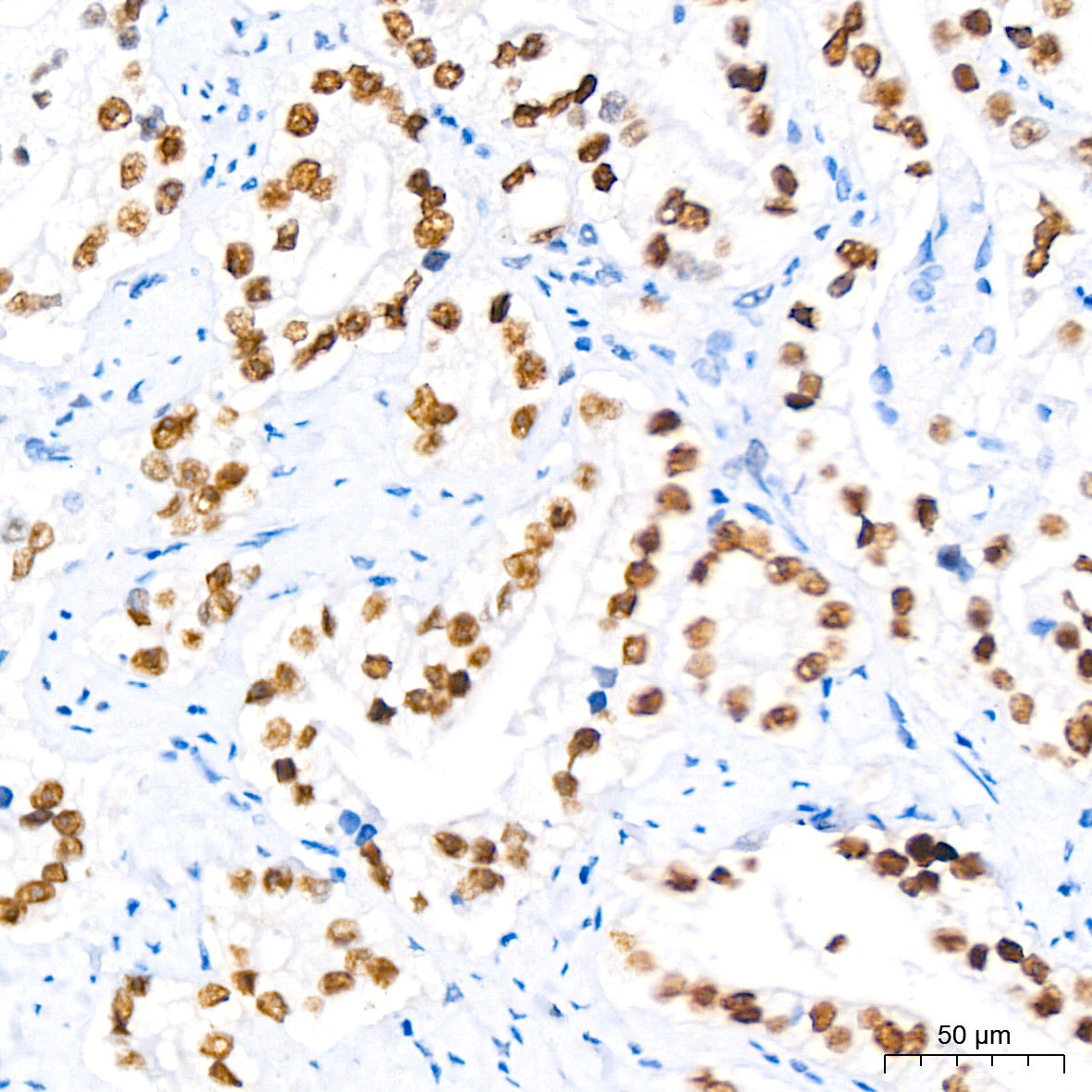 Androgen Receptor Rabbit mAb