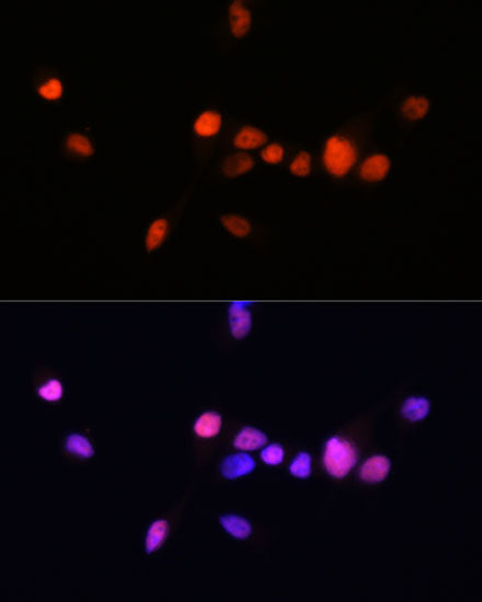 Androgen Receptor Rabbit mAb