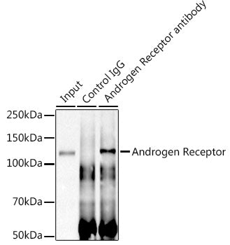 Androgen Receptor Rabbit mAb
