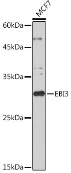 EBI3 Rabbit mAb