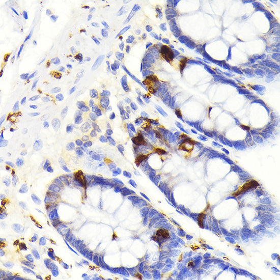 Secretagogin (SCGN) Rabbit mAb