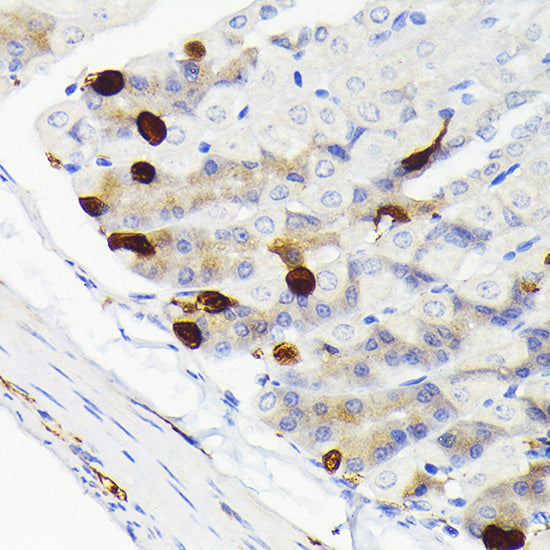 Secretagogin (SCGN) Rabbit mAb