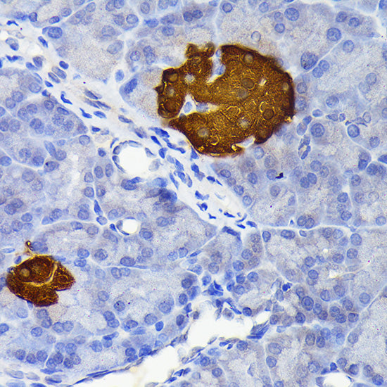 Secretagogin (SCGN) Rabbit mAb