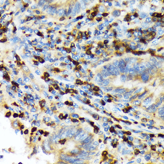 TACC3 Rabbit mAb