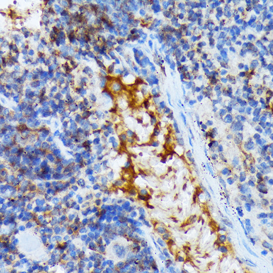 TACC3 Rabbit mAb