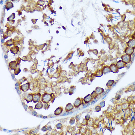 TACC3 Rabbit mAb