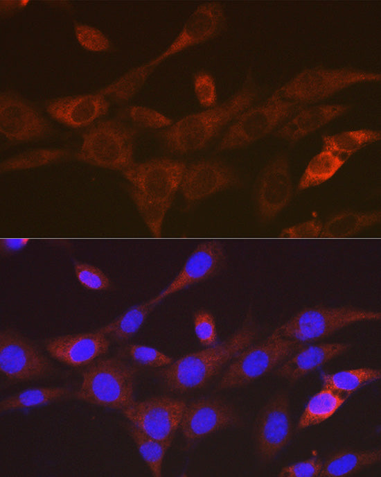 TACC3 Rabbit mAb