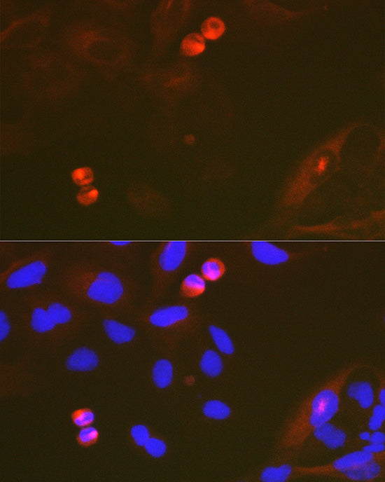 TACC3 Rabbit mAb