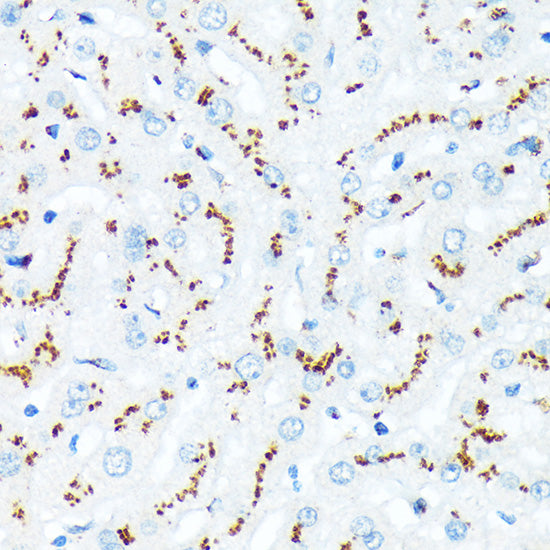 TGN46/TGOLN2 Rabbit mAb