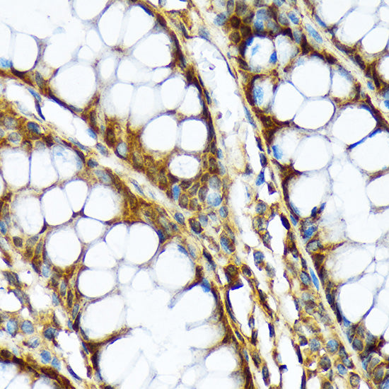 ABCF1 Rabbit mAb