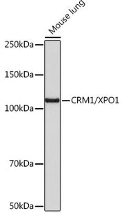 CRM1/XPO1 Rabbit mAb