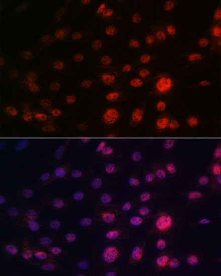 CRM1/XPO1 Rabbit mAb