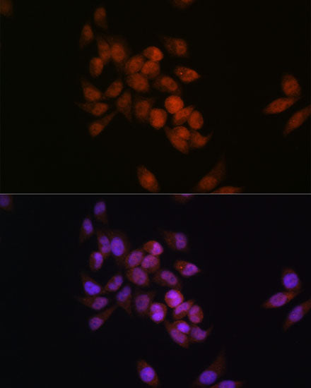 CRM1/XPO1 Rabbit mAb