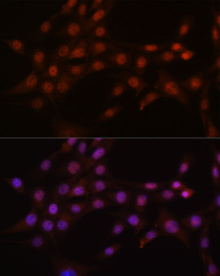 CRM1/XPO1 Rabbit mAb