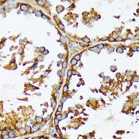 ACC1 Rabbit mAb