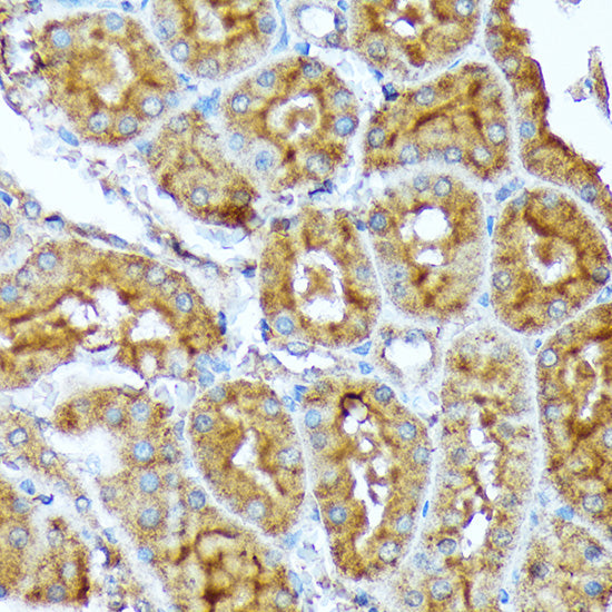ACC1 Rabbit mAb