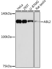 ABL2 Rabbit mAb