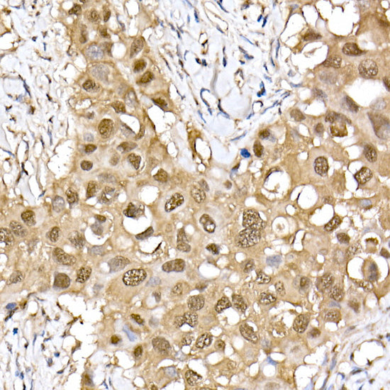 ERK2 Rabbit mAb
