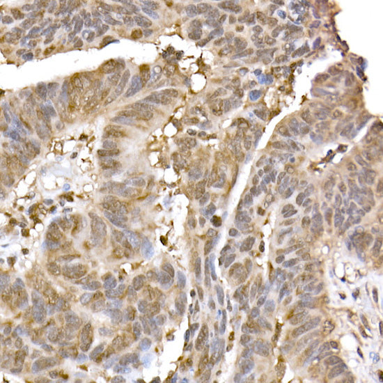 ERK2 Rabbit mAb