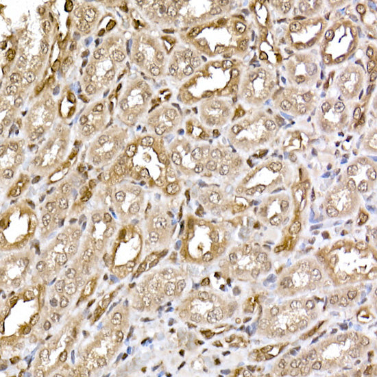 ERK2 Rabbit mAb