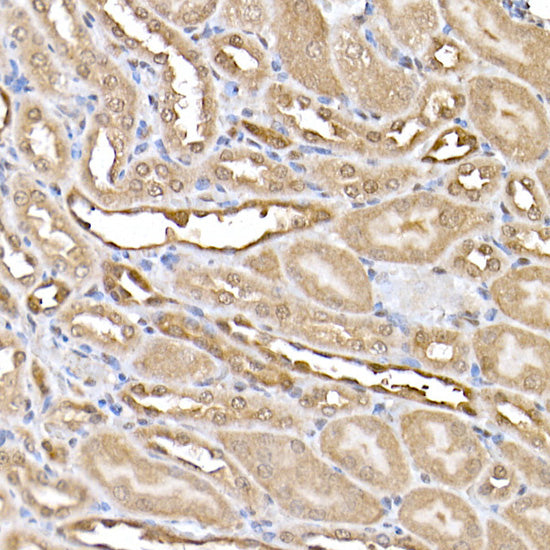 ERK2 Rabbit mAb