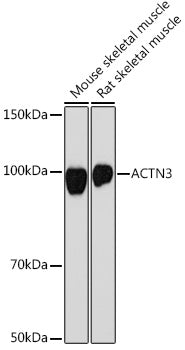 ACTN3 Rabbit mAb