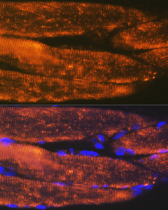 ACTN3 Rabbit mAb