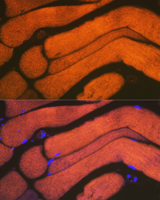 ACTN3 Rabbit mAb