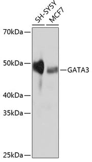 GATA3 Rabbit mAb