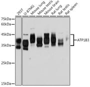 ATP1B3 Rabbit mAb