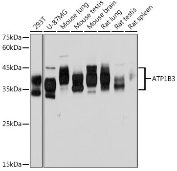 ATP1B3 Rabbit mAb
