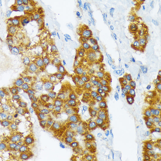 ATP1B3 Rabbit mAb
