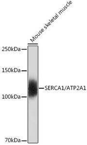 SERCA1/ATP2A1 Rabbit mAb