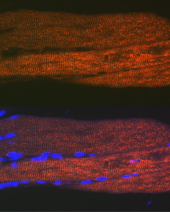 SERCA1/ATP2A1 Rabbit mAb