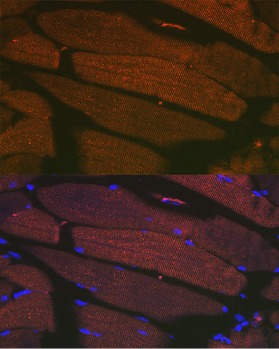 SERCA1/ATP2A1 Rabbit mAb