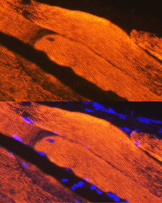 Calsequestrin 1 Rabbit mAb