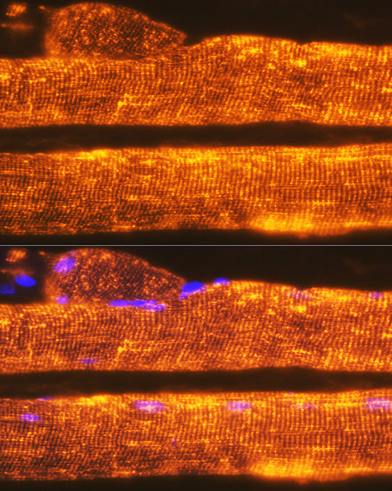 Calsequestrin 1 Rabbit mAb