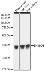 ENTPD5 Rabbit mAb