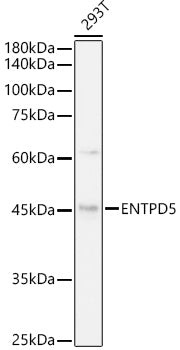 ENTPD5 Rabbit mAb