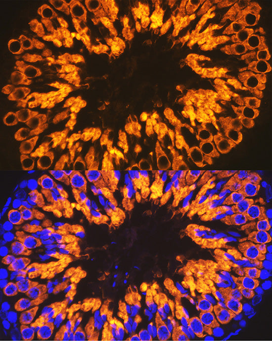 Calmegin Rabbit mAb