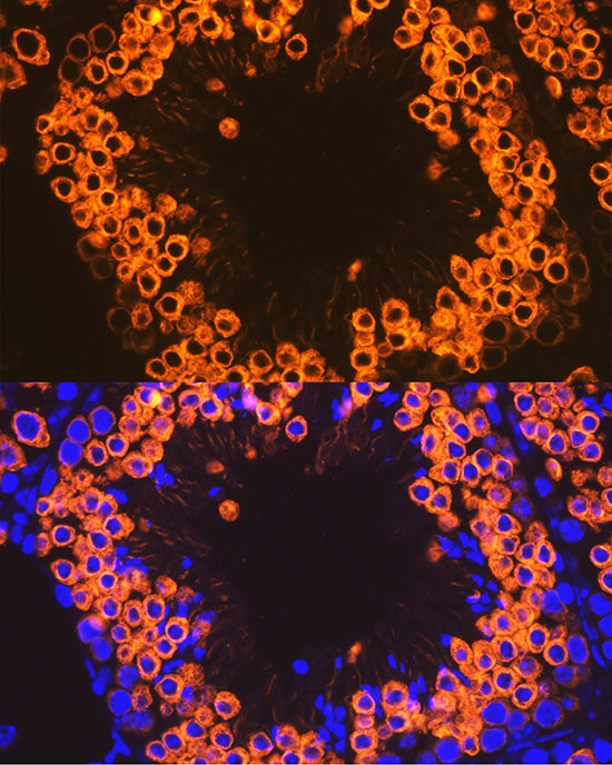 Calmegin Rabbit mAb