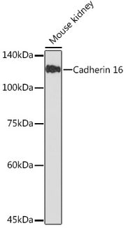 Cadherin 16 Rabbit mAb