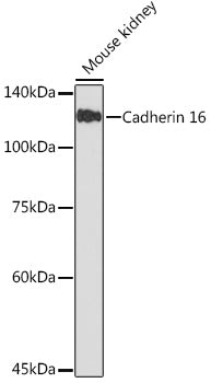 Cadherin 16 Rabbit mAb