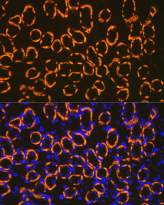 Cadherin 16 Rabbit mAb