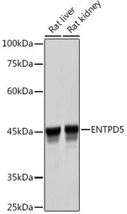 ENTPD5 Rabbit mAb