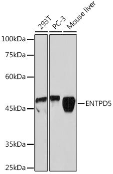 ENTPD5 Rabbit mAb